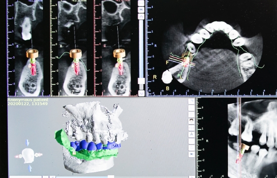 ALL-on-4 オールオンフォー!